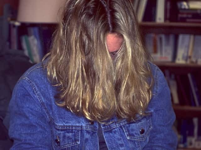Teenager with acne